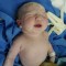 Neonato